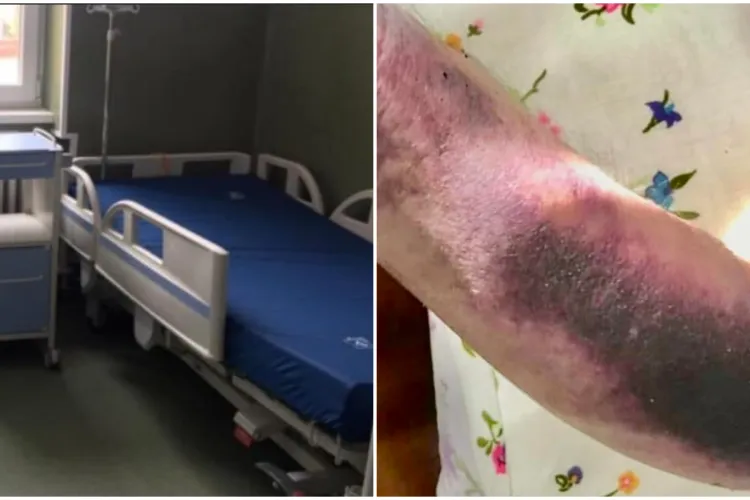 Imaginea care a șocat comunitatea medicală. Revolta unei asistente din Cluj: „ A reușit performanța să bifeze tot ce scrie la capitolul nepăsare!”