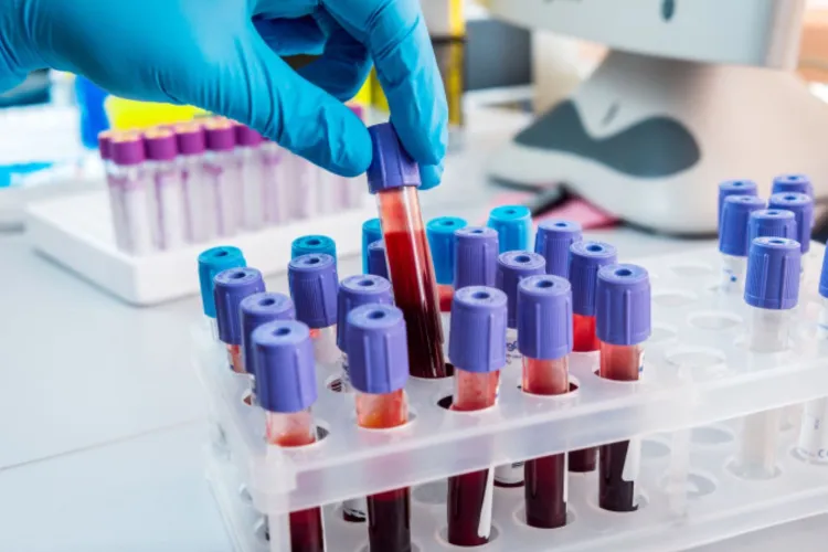 Ce analize de sânge poți să-ți faci gratuit dacă ești asigurat CAS, de fapt. Ministerul a publicat lista oficială: Puțini clujeni știu asta