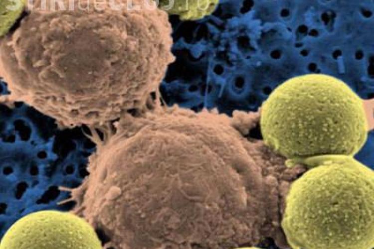 Cercetatorii sustin ca au descoperit primul tratament sigur impotriva cancerului