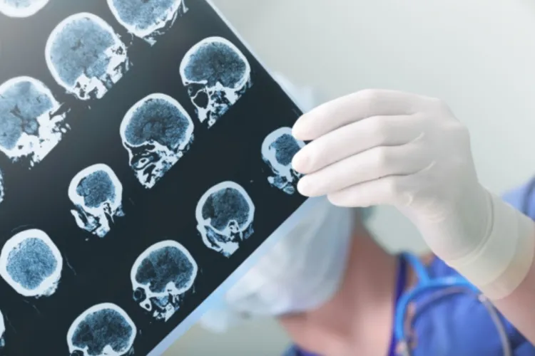 Un tratament revoluționar ar putea salva pacienții care suferă un AVC: Ce au descoperit cercetătorii este incredibil