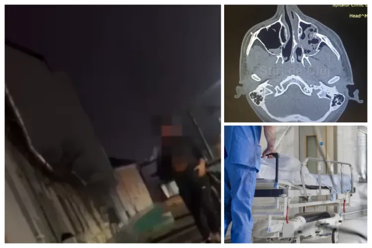 Băiatul de 15 ani, desfigurat de alt adolescent când aștepta taxiul, a trecut cu bine de operație: „I-au montat două plăcuțe pentru a-i reconstrui chipul”