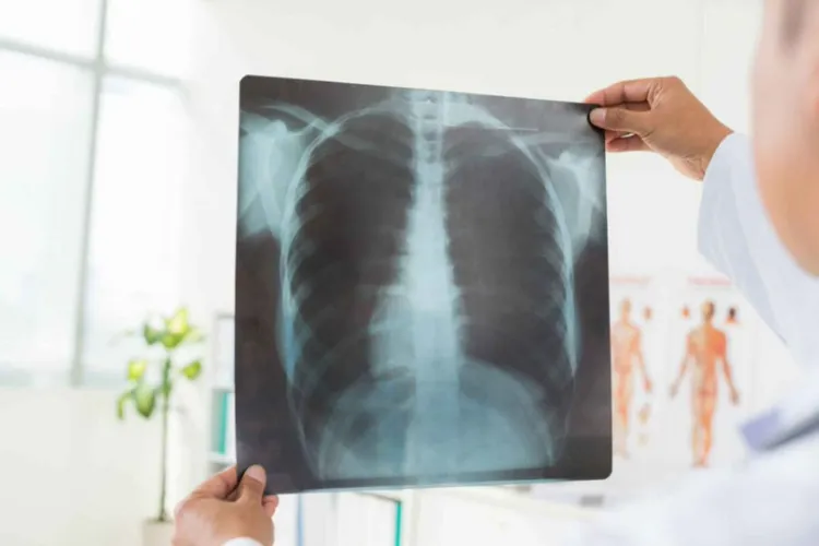 Anchetă. Zeci de medici radiologi, inclusiv din Cluj, acuzați că își „vând parafele” la privați:„Nu calcă în clinicile ălea, dar iau și 10 mii lei pe lună”