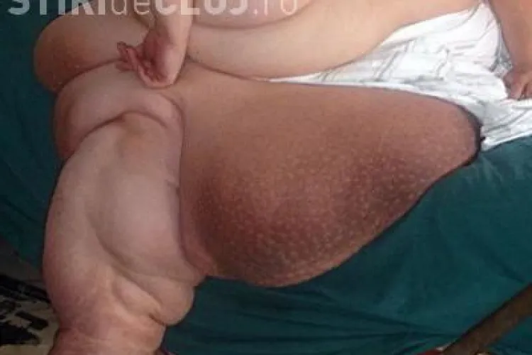 O femeie care cantareste 330 de kilograme vrea sa ajunga la o tona! Vezi cat mananca pe zi VIDEO