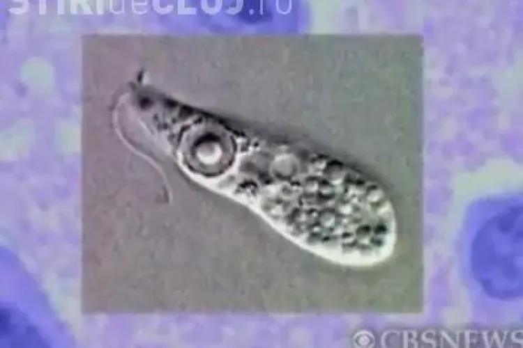 Amiba, vietatea care se hraneste cu creierul uman. A ucis in America doi copii si un tanar