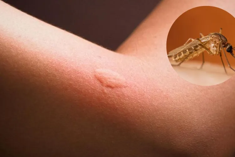 Virusul West Nile face prima victimă din acest sezon în România! Trei persoane s-au infectat în câteva săptămâni: Cum te poți proteja de înțepături
