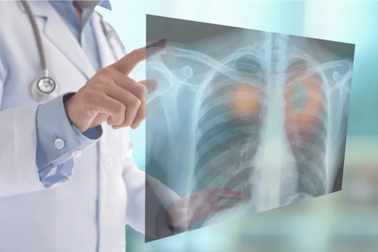 Un medic clujean avertizează tinerii fumători: „Vapingul afectează plămânii mai repede decât fumatul clasic”