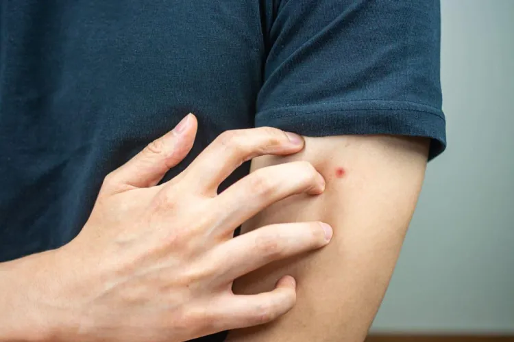 Coșmarul verii revine în Cluj-Napoca: Insecte care se lipesc de haine, corp și păr îi scot din minți pe locuitori: „Autoritățile trebuie să intervină”