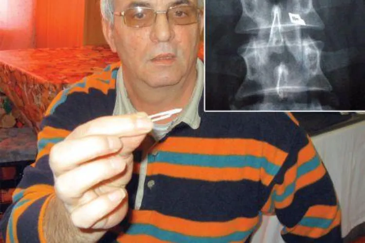 Pacientul care il acuza pe chirurgul Stefan Florian ca i-a uitat un bisturiu in coloana a mai primit o lovitura. Instanta i-a respins pretentiile materiale