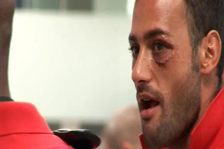 Beto, portarul facut KO de Wesley, are 13 copci in zona ochiului stang: "Fotbalul romanesc e dur si agresiv!" VIDEO