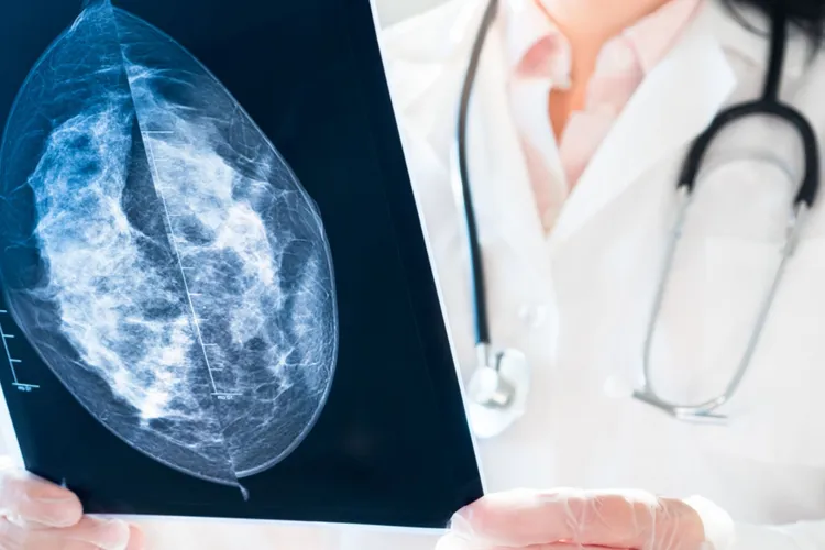 Cercetarea medicală din Cluj trece granițele! Un medic UBBMed, coautor al unui ghid internațional pentru pacientele operate de cancer de sân