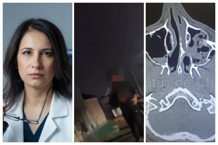 Băiatul medicului bătut și desfigurat pe stradă în Cluj, a trecut prin a doua operație. Mama lui Luca: „Plăcuțele montate pentru fracturi au fost scoase”