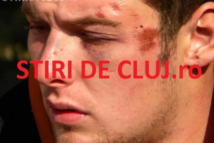 Un student acuza ca politistii din Cluj l-au batut cu bestialitate in fata la Janis la Stuf VIDEO EXCLUSIV
