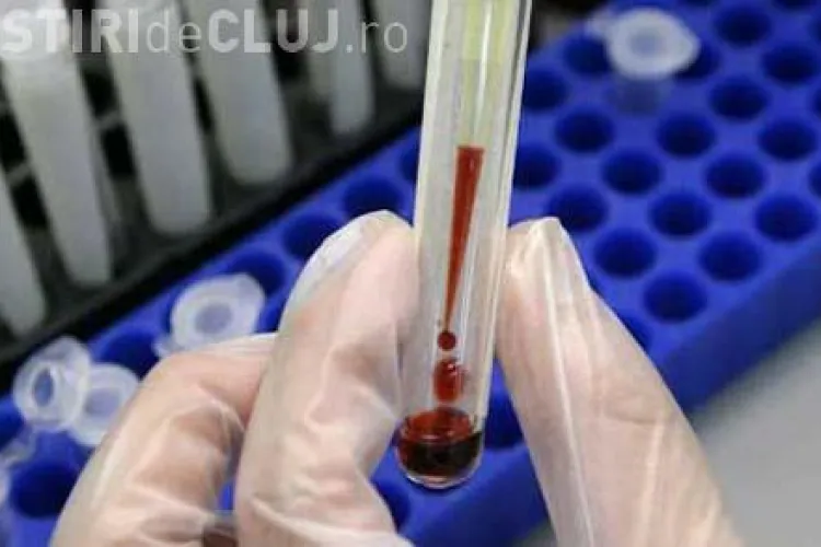 1000 de romani aparent sanatosi, testati intr-o campanie nationala, au fost depistati cu hepatita C. Mergeti la teste pana nu e prea tarziu!