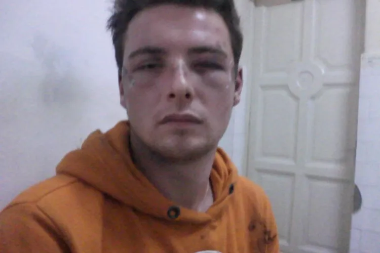 Studentul de la Jurnalistica, care acuza politia ca l-a batut, a fost si amendat cu 500 de lei pentru "atitudine ireverentioasa"