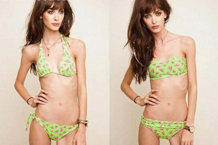 Fotomodel interzis in Scotia pentru ca e prea slab FOTO