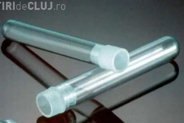 Virusul HIV, diagnosticat din saliva si in Romania din 2012. Vezi cum functioneaza metoda