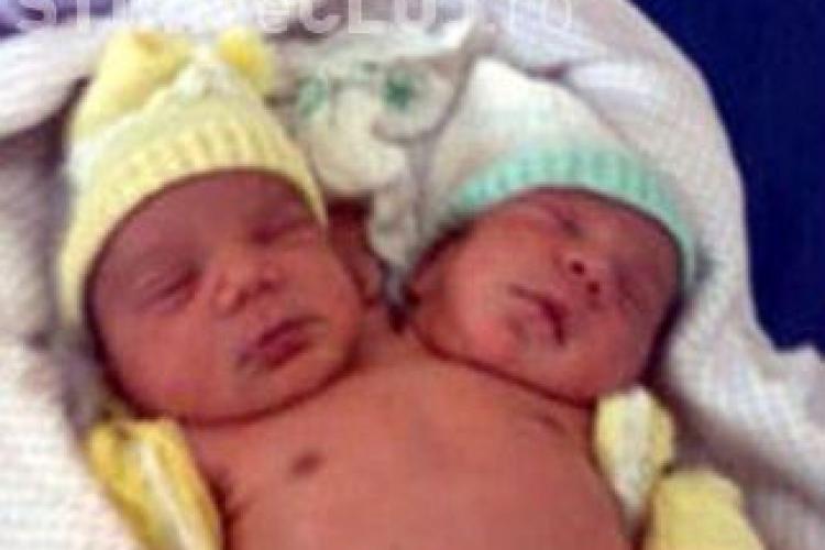 Un copil cu doua capete s-a nascut in Brazilia FOTO