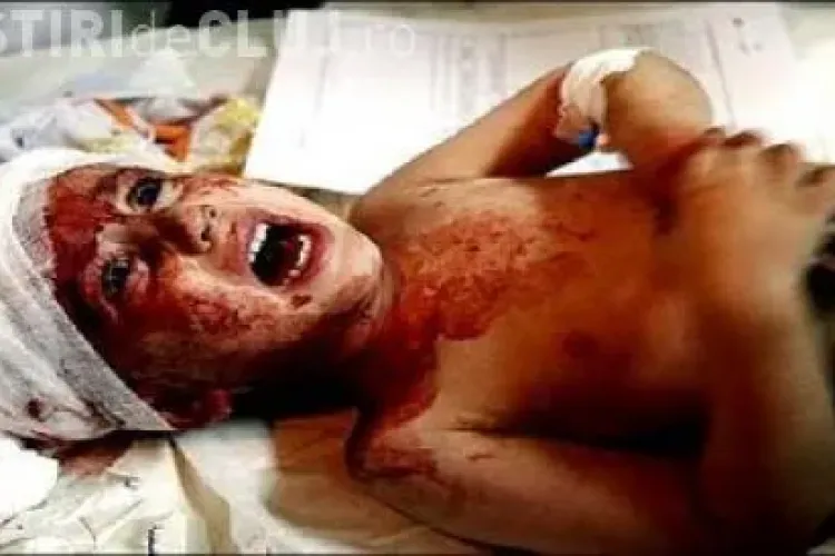 Copii arsi de vii in urma unui accident rutier 