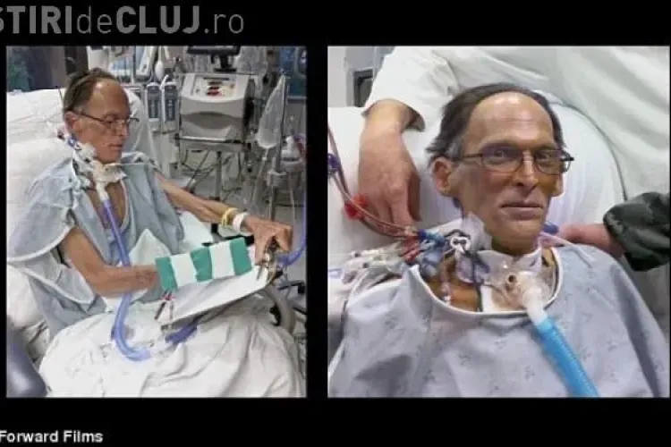 Un barbat traieste fara inima! Vezi o poveste incredibila VIDEO