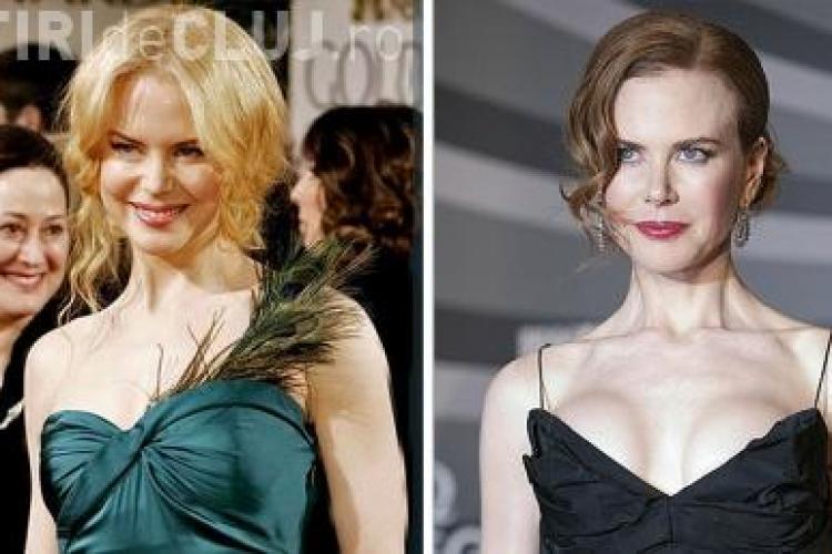 Nicole Kidman si-a pus silicoane 