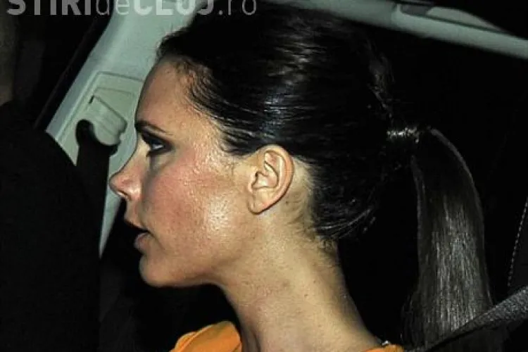 Victoria Beckham, plina de cosuri pe fata FOTO