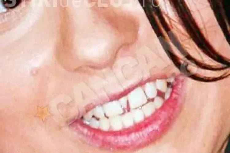 Inna, cu dintii rupti inainte de a deveni vedeta! VIDEO