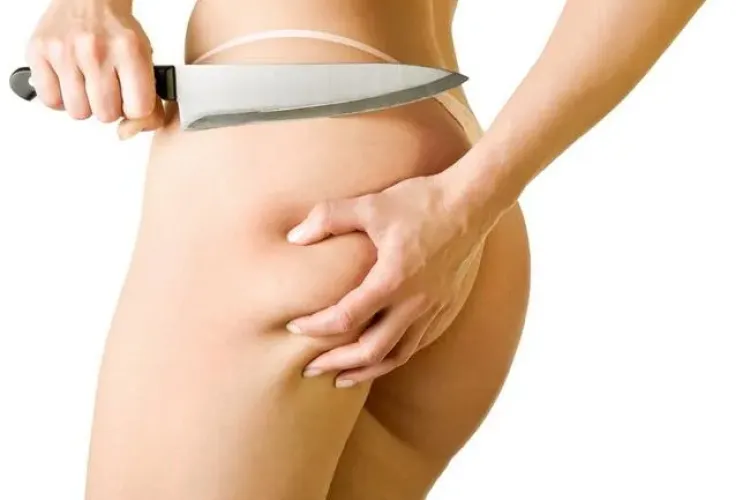 Cum să scapi de celulită! Vezi sfaturile Dr. OZ