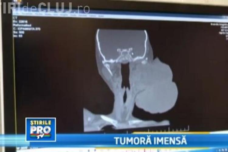 Caz ȘOCANT! O fetiță cu o tumoră de un kilogram la cap va fi operată la Cluj - VIDEO