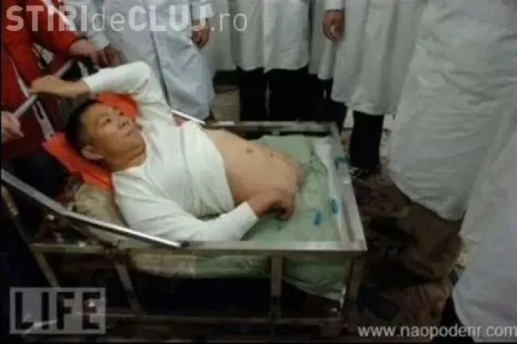 Gimnastul care a şocat medicii FOTO VIDEO