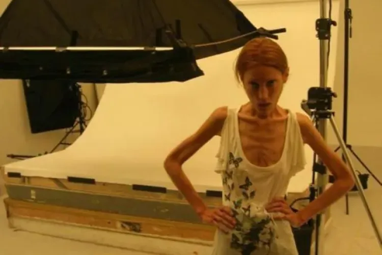 Tânăra care a murit pentru alte tinere! Avea doar 30 de kilograme înainte de a muri FOTO