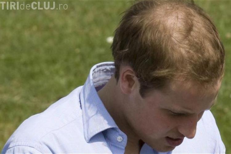 Veste şocantă pentru Prinţul WILLIAM. În câţiva ani va rămâne fără păr