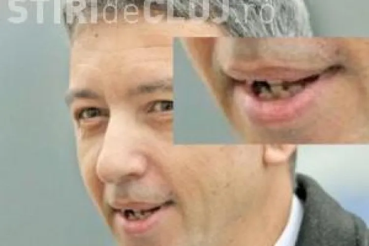 Dan Diaconescu, întrebat de ce nu își repară dinţii. AFLĂ răspunsul