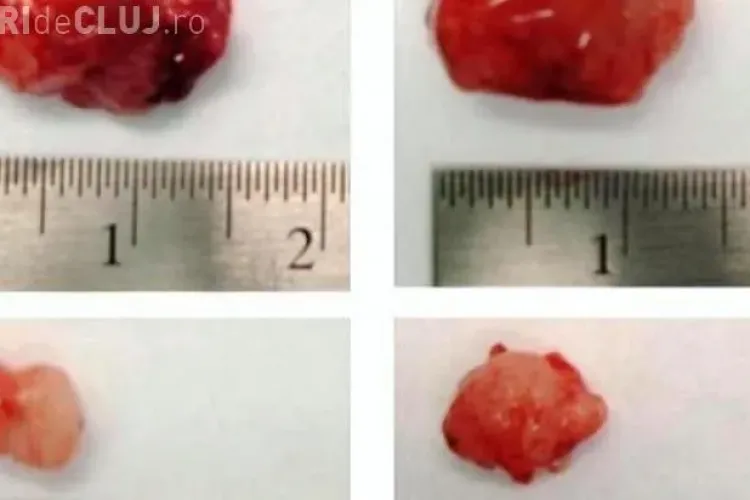 Cancerul ar putea fi tratat cu un conservat alimentar