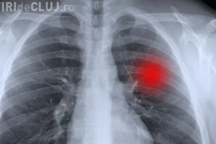 REVOLUȚIE ÎN MEDICINĂ: Aparatul care diagnostichează cancerul în 20 de minute