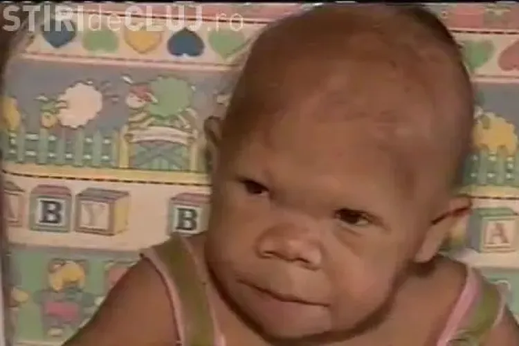 Caz medical INCREDIBIL! Are 30 de ani dar arata ca un copil de 9 luni