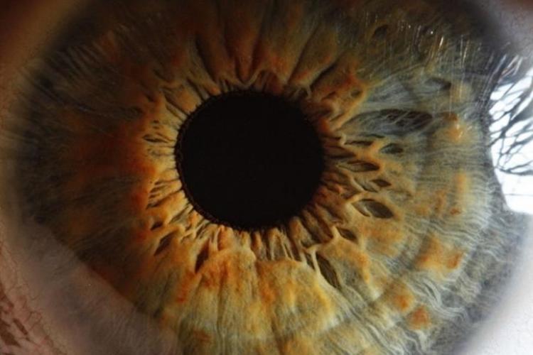 Imagini ULUITOARE ale ochiului uman