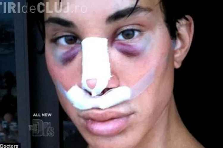 S-a operat pentru a semăna cu păpușa Ken - FOTO