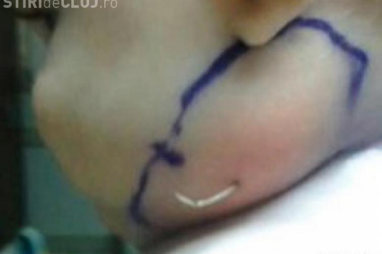 Imagini ŞOCANTE! Ce i-au găsit medicii în obraz unei fetiţe de 7 luni