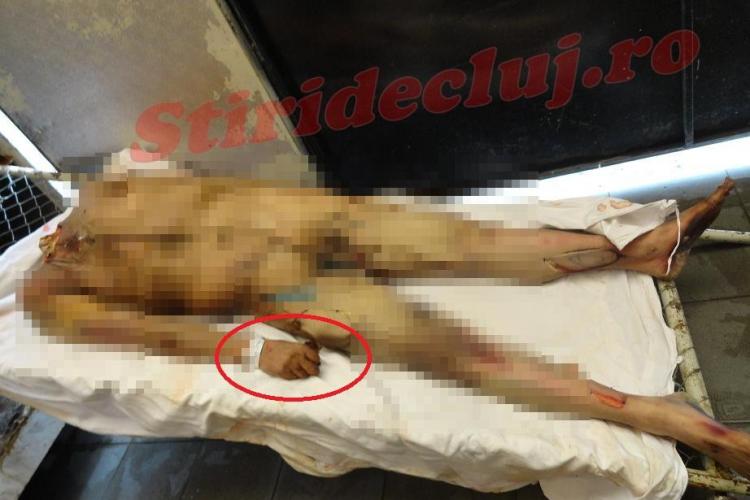 Chirurgii esteticieni italieni și-au și bătut joc de cadavrele de la IML Cluj. Unuia i-a fost tăiat organul genital - FOTO - IMAGINI ȘOCANTE
