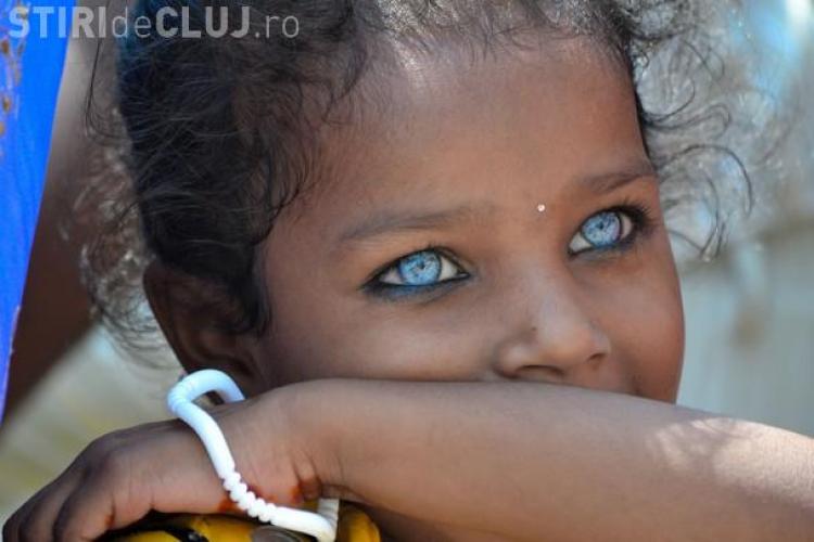 Cei mai frumoși ochi albastri din lume ascund o poveste dramatică - FOTO