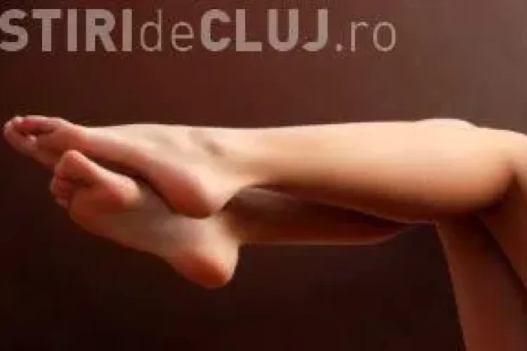 Cum să scapi de varice în 30 de minute