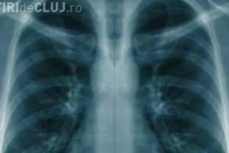 S-a descoperit alimentul care reduce riscul apariției cancerului cu 50%