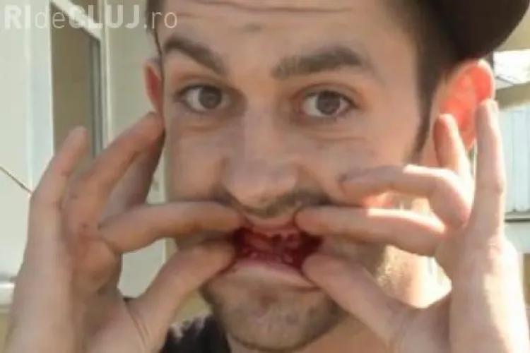 S-a dus la dentist și a ieșit fără niciun dinte în gură! Caz SCANDALOS