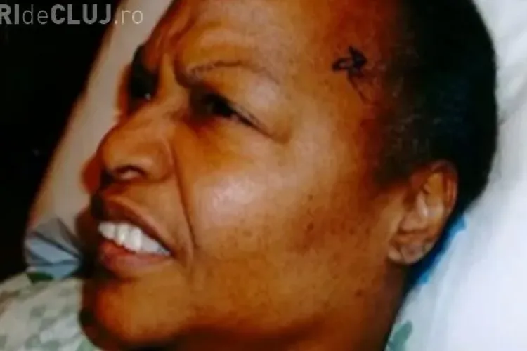 Medicii au încurcat operaţia pe creier. Pacienta e o legumă acum