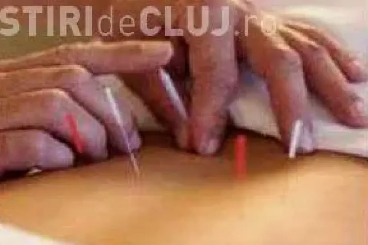 Dietă inedită: Cum poți slăbi prin acupunctură