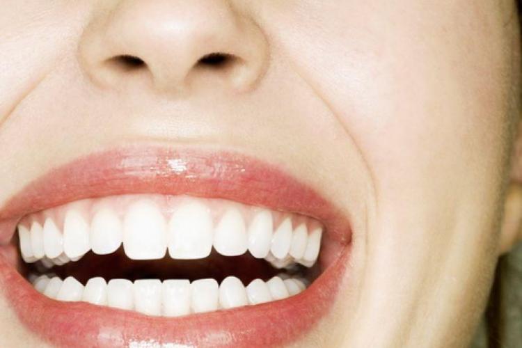 7 trucuri pentru a avea dinții mai albi