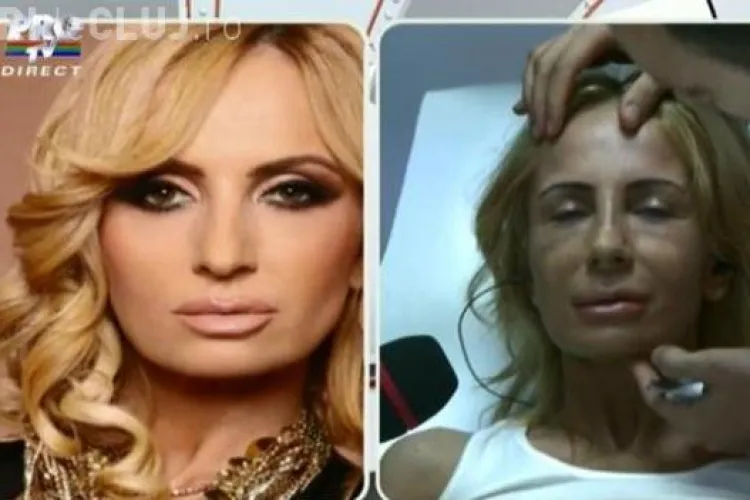 Imagini HORROR cu Daniela Gyorfi după operația estetică. Are fața tumefiată și buzele inegale - FOTO