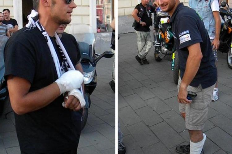 Motociclist cu 16 șuruburi în maxilar și mână, după un accident pe Varianta Zorilor - Mănăștur - VIDEO
