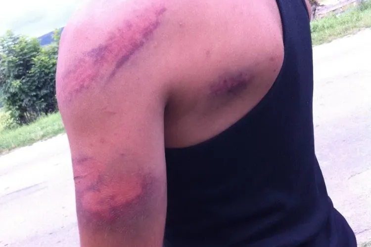 Scutul Negru cutremură Clujul. Poliția se face că nu vede scandalurile, iar interlopii bătuţi ameninţă că îşi fac singuri dreptate