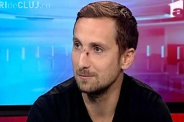 Dani Oţil a apărut la televizor plin de răni pe față. Explicația vedetei este de MILIOANE - FOTO